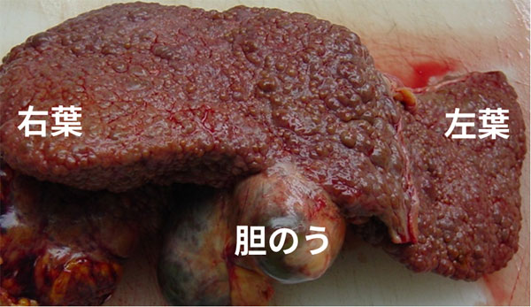 肝硬変の肝臓（剖検例）
