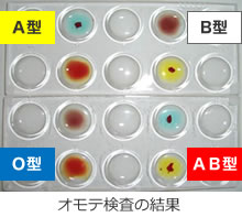 血液検査 血液型｜飯塚病院 中央検査部