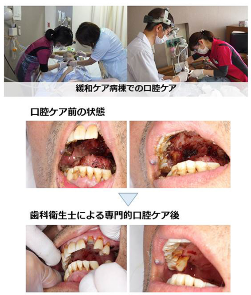 歯科衛生室について 飯塚病院 歯科口腔外科